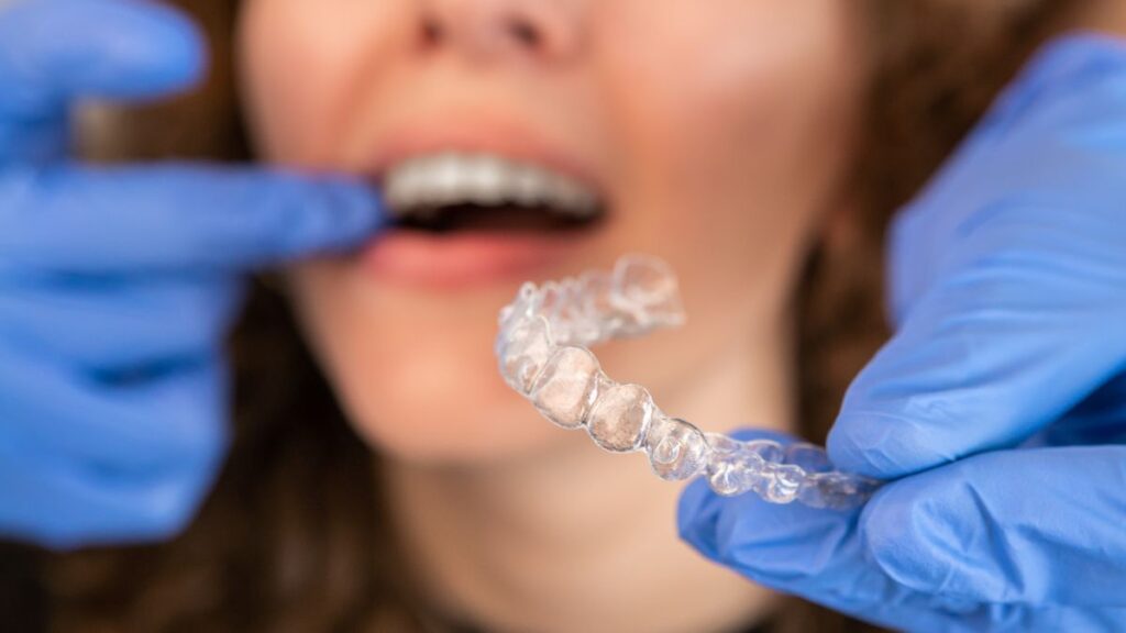 Blue-gloved hands hold up a clear dental aligner in front of a smiling mouth for inspection.
